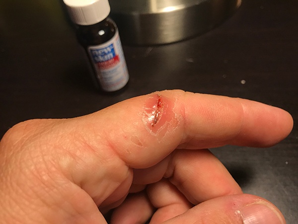 New Skin Liquid Bandage New Skin Liquid Bandage