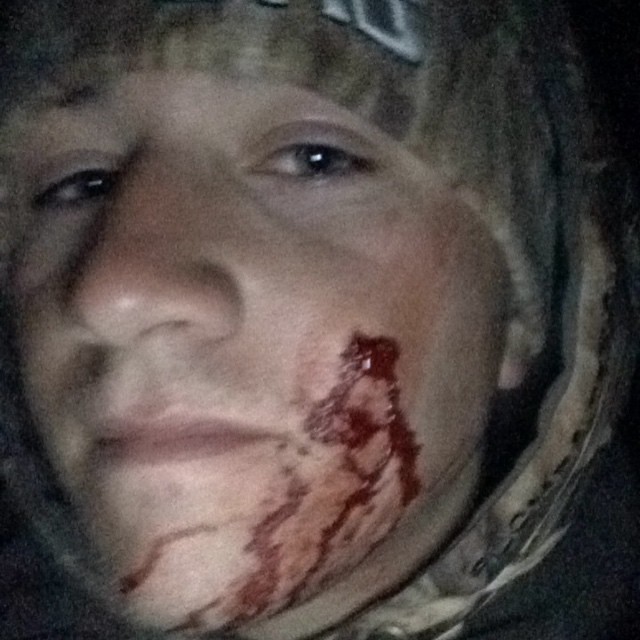 Zack Campo 1