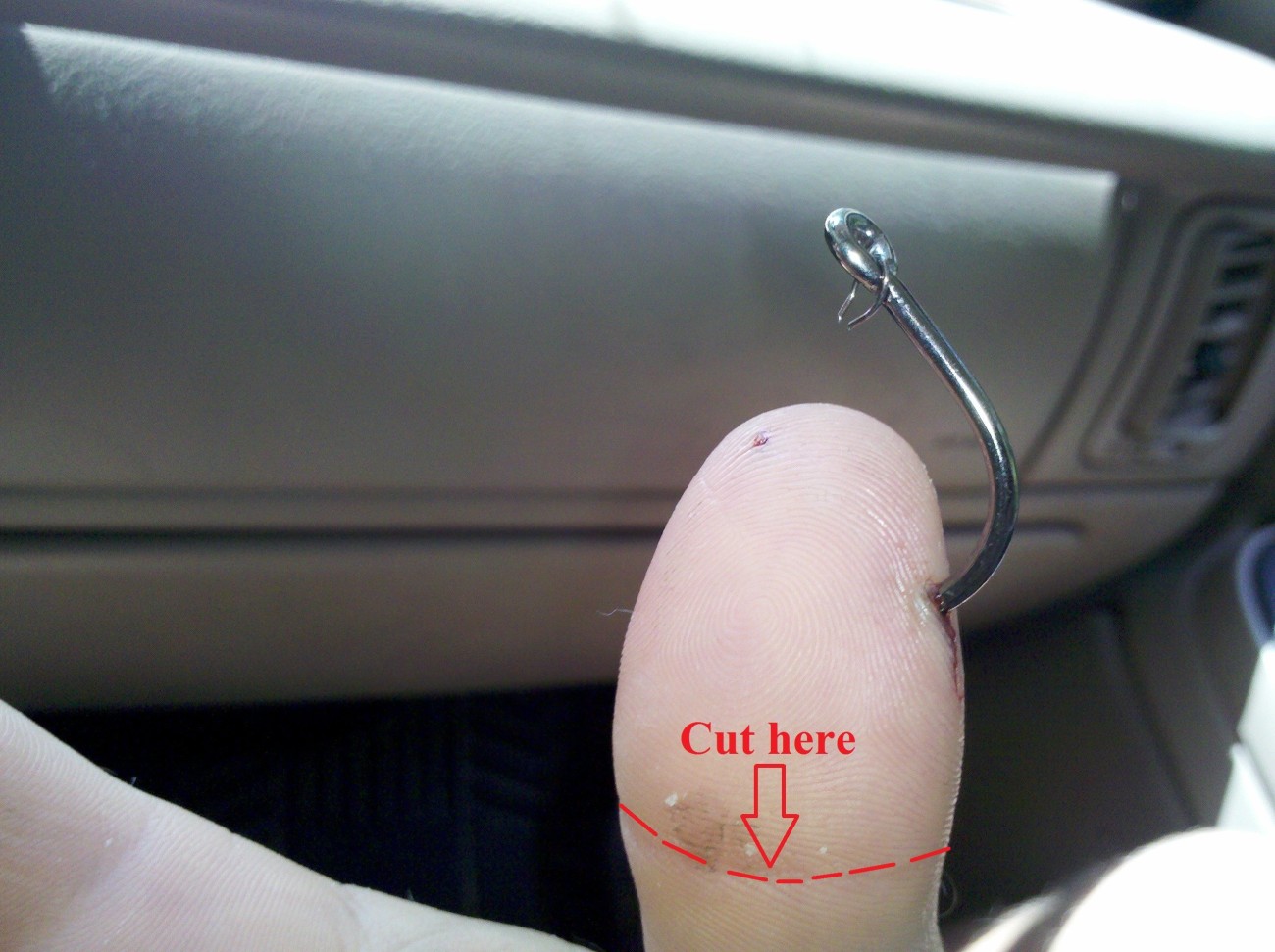 How To Remove A Hook